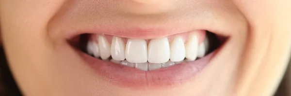 Vackert Leende Med Stora Friska Släta Vita Tänder Närbild Begreppet — Stockfoto
