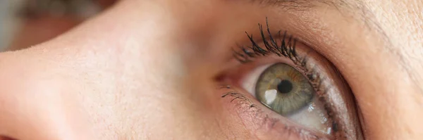 Kobieta Rasy Kaukaskiej Używająca Kropli Kapiąca Bliska Zespół Suchych Oczu — Zdjęcie stockowe