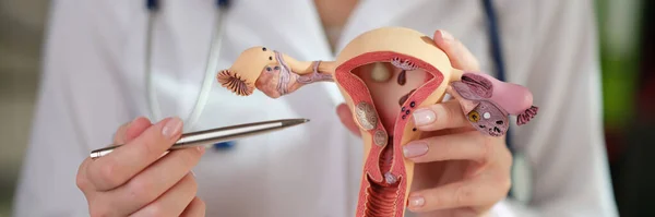 Női Nőgyógyász Bemutatja Női Reproduktív Rendszer Modelljét Orvosi Klinikán Nőgyógyászati — Stock Fotó