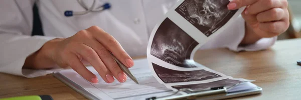 Ženský Lékař Analyzuje Výsledky Ultrazvuku Pro Diagnózu Pacienta Žena Pracující — Stock fotografie
