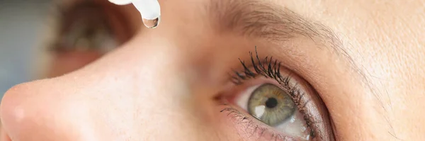Close Woman Applying Eye Drops Vitamin Drops Eye Diseases Solution — Fotografia de Stock