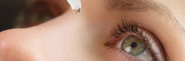 Close Woman Applying Medical Eye Drops Diseases Treatment Dry Eye — Stock Photo, Image