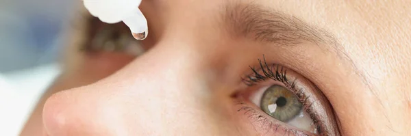 Close Middle Age Woman Face Dripping Eye Drops Treatment Conjunctivitis — Fotografia de Stock