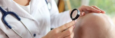 Close-up of female doctor examining male patient with hair loss problem at consultation in clinic. Dermatological diseases and hair loss, baldness concept