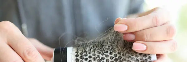 Close-up of woman hands holding comb full of hair. Woman losing hair. Hair loss concept