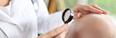 Kadın doktor, büyüteçten bakarken kel erkek hastanın kafa derisini kontrol ediyor. Deri hastalıkları, saç dökülmesi ve iyileşme kavramı.