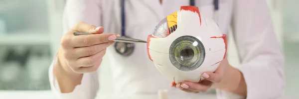 Naispuolinen Silmälääkäri Näyttää Anatominen Malli Ihmissilmän Istuessaan Pöydässä Lääkäriasemalla Silmäsairaudet — kuvapankkivalokuva