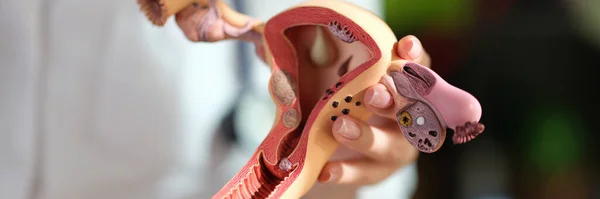 Model Van Vrouwelijke Voortplantingssysteem Artsen Hand Close Concept Van Gynaecologie Stockafbeelding