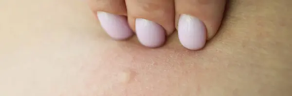 Female hand touches skin with rash. Dermatologist examines eczema. Patient shows problem areas on skin to doctor worrying about health