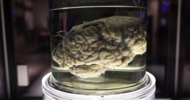 Tıbbi araştırmalar için formaldehitli cam kavanozda insan beyni. Beynin anatomisi