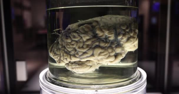 Människans Hjärna Glasburk Med Formaldehyd För Medicinsk Forskning Hjärnans Anatomi — Stockvideo
