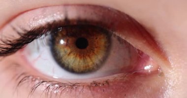 Kahverengi kadın insan gözü yakın plan. Miyop miyopluk astigmat.