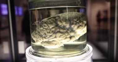 Formaldehit kavanozundaki insan beyni. Organların ve dokuların korunması