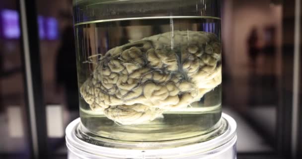 Mänskliga Hjärnor Formaldehydburklabbet Bevarande Organ Och Vävnader — Stockvideo