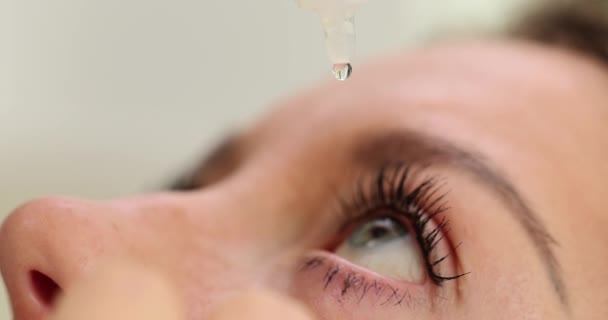 Donna Che Gocciola Gocce Medicinali Lacrime Naturali Negli Occhi Malattia — Video Stock