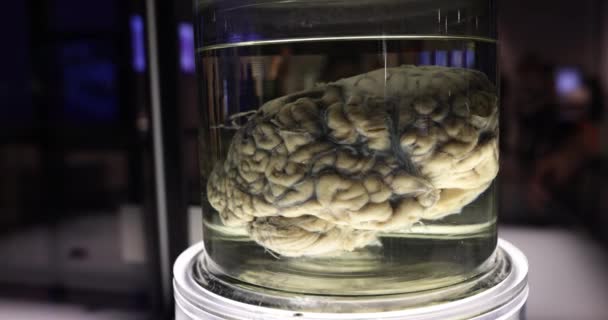 Órganos Museo Anatómico Cerebro Humano Órganos Humanos Frascos Con Formaldehído — Vídeos de Stock