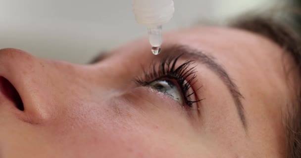 視力障害の女性は 医師の診察で眼球に特別なドロップをドロップします クリニックで身体的健康を改善するための処方薬 — ストック動画