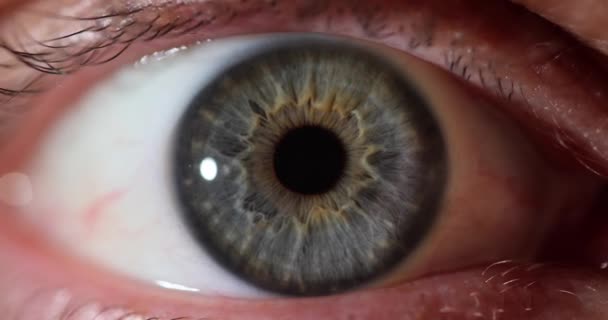 Hastanedeki Göz Doktoruyla Randevusu Olan Çok Renkli Irisli Bir Insan — Stok video
