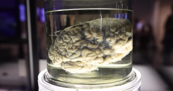 Cerebro Humano Fallecido Líquido Balsámico Para Preservación Museo Ciencias Líquido — Vídeos de Stock