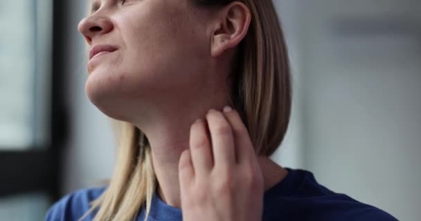 Young Woman Scratches Itchy Chest Neck Red Rash Causes Itchy — Stock Video