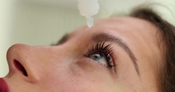 Mulher Paciente Gotejamento Colírio Olhos Closeup Filme Câmera Lenta Tratamento — Vídeo de Stock