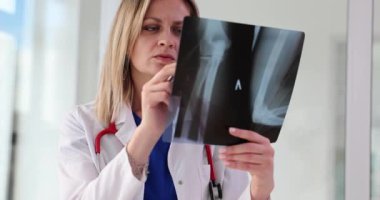 Woman traumatologist looking at xray with broken arm 4k movie slow motion. Traumatology and treatment of injuries and dislocations concept