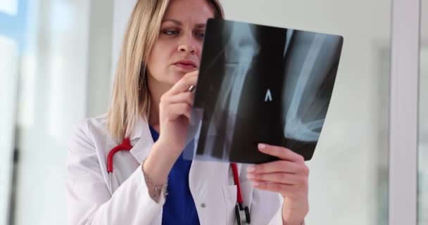 Woman Traumatologist Looking Xray Broken Arm Movie Slow Motion Traumatology — Wideo stockowe