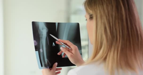 Traumatologue Examine Les Radiographies Coude Des Bras Arthrose Des Mains — Video