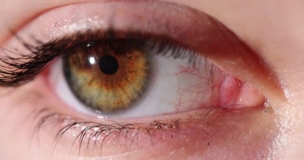 Kahverengi Kornealı Kadın Gözüne Yakın Çekim Uzaklık Miyop Lazer Görme — Stok video