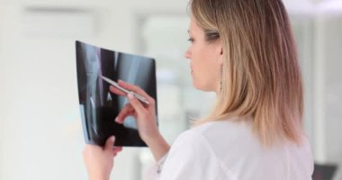 Kadın cerrah, hastanın kırık bacağının röntgen filmini dikkatlice öğreniyor. Kadın durumu ustalıkla değerlendirir ve sonraki adımları varsayar.