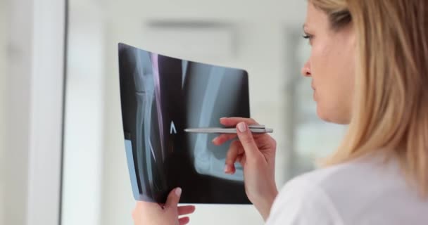 Vrouwelijke Dokter Onderzoekt Röntgenfoto Van Armbeenderen Van Patiënten Gevolgen Van — Stockvideo