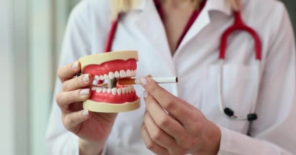 歯科医の手の顎とタバコの歯科モデル 歯への喫煙の影響 — ストック動画