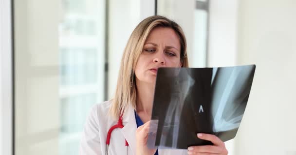 Radiografía Del Brazo Del Paciente Los Huesos Del Codo Clínica — Vídeo de stock
