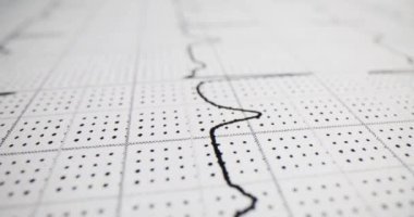 EKG ya da EKG çıktısı hastanın kalp atışlarını ve elektriksel aktivitelerini gösteriyor. Yetişkin elektrokardiyogramı ve tıbbi muayenenin doğrusal görüntüsü