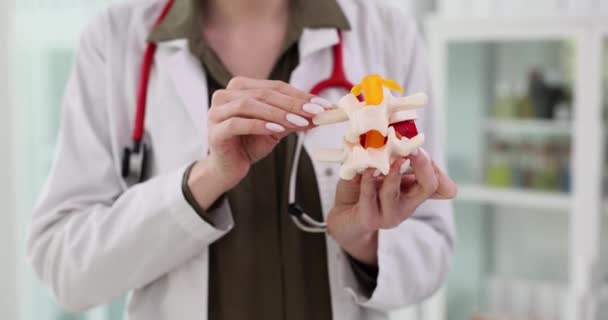 Chirurg Mundurze Medycznym Posiada Sztuczny Model Kręgu Specjalista Wyjaśnia Przepukliny — Wideo stockowe