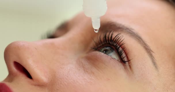 Drops Vial Dripping Woman Eye Closeup Conjunctivitis Treatment Concept — Vídeos de Stock