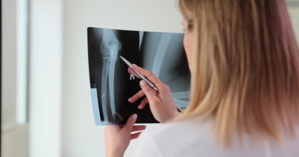 Vrouwelijke Traumatoloog Onderzoekt Röntgenfoto Van Arm Elleboog Elleboogpijn Oorzaken Diagnose — Stockvideo