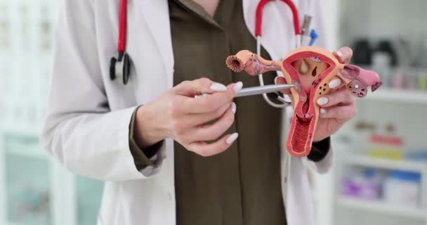Гинеколог Показывает Анатомическую Модель Матки Руке Структура Женских Репродуктивных Органов — стоковое видео