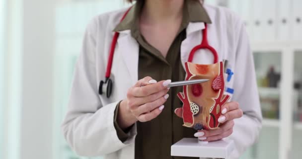 Médico Muestra Las Enfermedades Del Recto Modelo Artificial Del Órgano — Vídeos de Stock