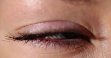 Görünür kan damlaları, sulu göz kapakları ve yumuşak lensleri olan bir kadın gözü. Alerjiler ve kontak lensler ve lens çözeltisi