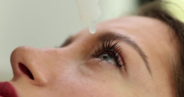 Крупный План Женщины Прикладывающей Глазные Капли Глазу Капли Глаз Аллергии — стоковое видео
