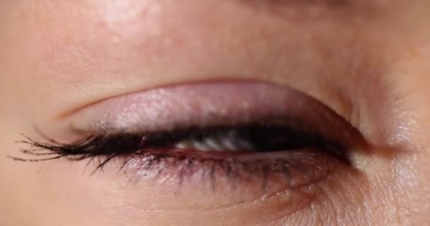 Closeup Woman Eye Visible Bloodshot Veins Watery Eyelid Soft Contact — Stock Video