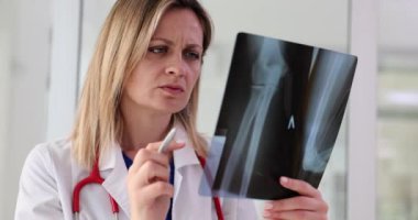 Travmatolog, dirsek ve kol kemiklerinin röntgenlerini inceliyor. Ellerin eklemlerinde ve kaslarında ağrı