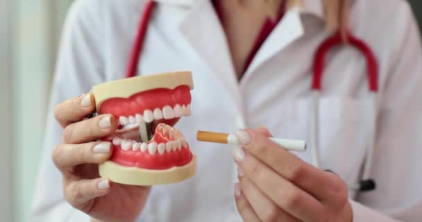 Vrolijke Arts Voegt Regelmatige Sigaret Realistische Model Van Kunstmatige Kaak — Stockvideo