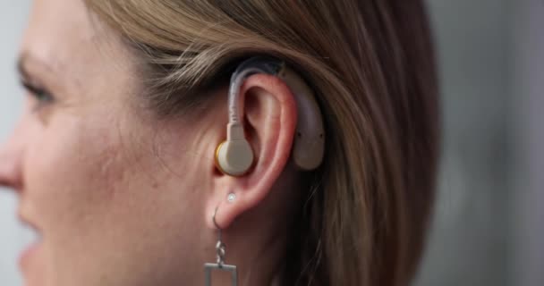 女性は話し合いに参加するための補聴器を身に着けています 女性は効果的なコミュニケーションのためにオーロラに固定された補聴器に依存して検査室に立っています — ストック動画