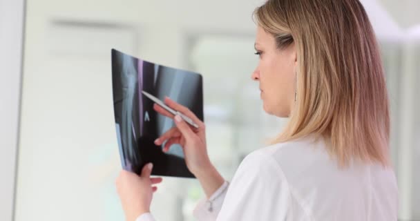 Läkaren Undersöker Röntgenbilder Som Studerar Benstrukturen Kvinnlig Läkare Med Fokuserat — Stockvideo