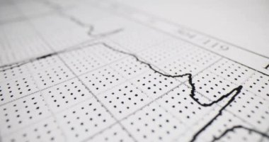 Klinikteki delinmiş kağıt üzerinde hasta EKG çizelgesi. Hastanede elektrik teçhizatıyla kalp atışı testi. Kardiyogram grafik bilgisi