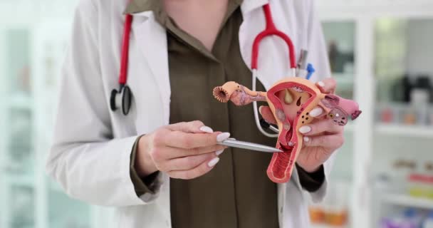 Dokter Demonstreert Menselijk Baarmoeder Model Het Ziekenhuis Kantoor Gynaecoloog Legt — Stockvideo