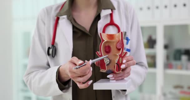Proctologist는 클리닉에서 현실적인 모델을 직장을 보여줍니다 의사는 약속시 환자에게 위험을 — 비디오