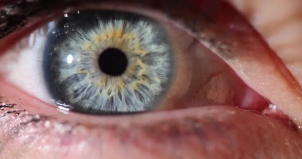 Göz Doktoruyla Hastanede Randevusu Olan Parlak Iris Hastası Bir Insan — Stok video